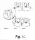 Fig. 10 - Encoding and decoding a multi-view video signal