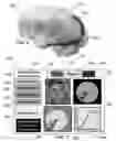 Fig. 07 - Method and system for quantitative assessment of visual contrast sensitivity