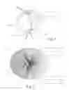 Fig. 04 - RNFL measurement analysis