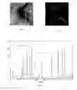 Fig. 06 - RNFL measurement analysis