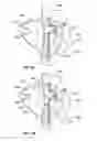 Fig. 06 - Securable cover with electrically activatable light inhibiting lens for vehicle lights