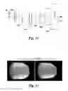 Fig. 10 - Method and system for contactless fingerprint detection and verification