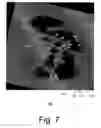Fig. 09 - Systems and methods for computer-aided fold detection