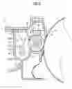 Fig. 04 - Cleaning device for an image forming unit