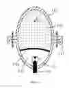 Fig. 09 - Methods and devices for cleaning and sterilization with shock waves