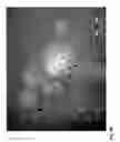 Fig. 07 - NANOPARTICLES FOR TARGETED DELIVERY OF ACTIVE AGENTS TO THE LUNG