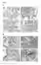 Fig. 12 - NANOPARTICLES FOR TARGETED DELIVERY OF ACTIVE AGENTS TO THE LUNG