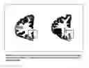 Fig. 02 - BIOMARKERS FOR DEPRESSION