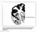 Fig. 03 - BIOMARKERS FOR DEPRESSION
