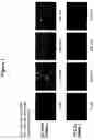 Fig. 02 - Labeled inhibitors of prostate specific membrane antigen (PSMA), biological evaluation, and use as imaging agents