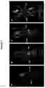 Fig. 04 - Labeled inhibitors of prostate specific membrane antigen (PSMA), biological evaluation, and use as imaging agents