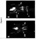 Fig. 05 - Labeled inhibitors of prostate specific membrane antigen (PSMA), biological evaluation, and use as imaging agents