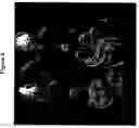 Fig. 06 - Labeled inhibitors of prostate specific membrane antigen (PSMA), biological evaluation, and use as imaging agents