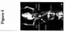 Fig. 07 - Labeled inhibitors of prostate specific membrane antigen (PSMA), biological evaluation, and use as imaging agents