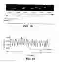 Fig. 02 - METHOD TO IDENTIFY A PATIENT WITH AN INCREASED LIKELIHOOD OF RESPONDING TO AN ANTI-CANCER AGENT