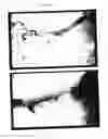 Fig. 83 - Pluripotent embryonic-like stem cells, compositions, methods and uses thereof