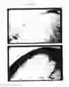 Fig. 87 - Pluripotent embryonic-like stem cells, compositions, methods and uses thereof