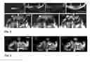 Fig. 03 - Methods and Kits for Enhancing Cell Survival, Stimulating Cell Proliferation, Treating Diabetic Patients, and/or Reinnervation