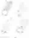 Fig. 06 - METHOD FOR PRODUCING A THREE-DIMENSIONAL MACROPOROUS FILAMENT CONSTRUCT BASED ON PHASE INVERSION AND CONSTRUCT THEREBY OBTAINED