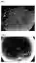 Fig. 06 - SCAFFOLDS