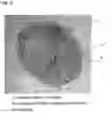 Fig. 09 - SCAFFOLDS