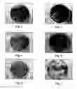 Fig. 07 - Materials for travelled surfaces
