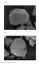 Fig. 02 - Cathode active material for lithium secondary battery