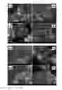 Fig. 08 - Process of preparing PT/support or PT alloy/support catalyst, thus-prepared catalyst and fuel cell comprising the same
