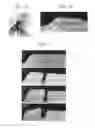 Fig. 02 - Orthodontic methods and devices