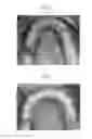 Fig. 07 - Orthodontic methods and devices