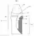 Fig. 04 - Two-Part Dental Implant