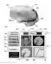 Fig. 07 - METHOD AND SYSTEM FOR QUANTITATIVE ASSESSMENT OF VERBAL RECOGNITION MEMORY
