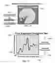 Fig. 40 - METHOD AND SYSTEM FOR QUANTITATIVE ASSESSMENT OF VERBAL RECOGNITION MEMORY