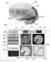 Fig. 07 - METHOD AND SYSTEM FOR QUANTITATIVE ASSESSMENT OF WORD RECOGNITION SENSITIVITY