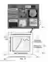 Fig. 16 - METHOD AND SYSTEM FOR QUANTITATIVE ASSESSMENT OF WORD RECOGNITION SENSITIVITY