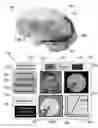 Fig. 07 - Method and system for quantitative assessment of verbal memory