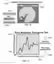 Fig. 40 - Method and system for quantitative assessment of verbal memory