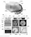 Fig. 07 - Method and system for quantitative assessment of facial emotion sensitivity
