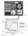 Fig. 16 - Method and system for quantitative assessment of facial emotion sensitivity