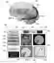 Fig. 07 - METHOD AND SYSTEM FOR QUANTITATIVE ASSESSMENT OF SPATIAL SEQUENCE MEMORY
