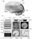 Fig. 07 - METHOD AND SYSTEM FOR QUANTITATIVE ASSESSMENT OF SOCIAL INTERACTIONS NULLING TESTING