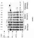 Fig. 04 - Strain of SARS-associated coronavirus and applications thereof
