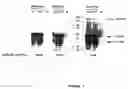 Fig. 08 - Strain of SARS-associated coronavirus and applications thereof