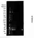 Fig. 91 - Strain of SARS-associated coronavirus and applications thereof
