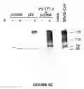 Fig. 93 - Strain of SARS-associated coronavirus and applications thereof