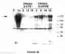 Fig. 96 - Strain of SARS-associated coronavirus and applications thereof