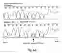 Fig. 13 - Polynucleotide encoding an ATP binding cassette transporter 1 (ABC1) polypeptide