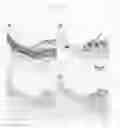 Fig. 09 - Atherosclerosis marker and use thereof