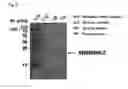 Fig. 05 - METHOD FOR DETERMINING PROGNOSIS OF ACUTE CENTRAL NERVOUS SYSTEM DISORDER