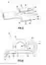 Fig. 04 - Electrical terminal with hermaphiditic connection section